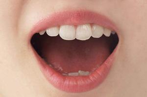 盛岡での交通事故治療：信頼できる施術者による効果的な回復法と保険活用ガイド